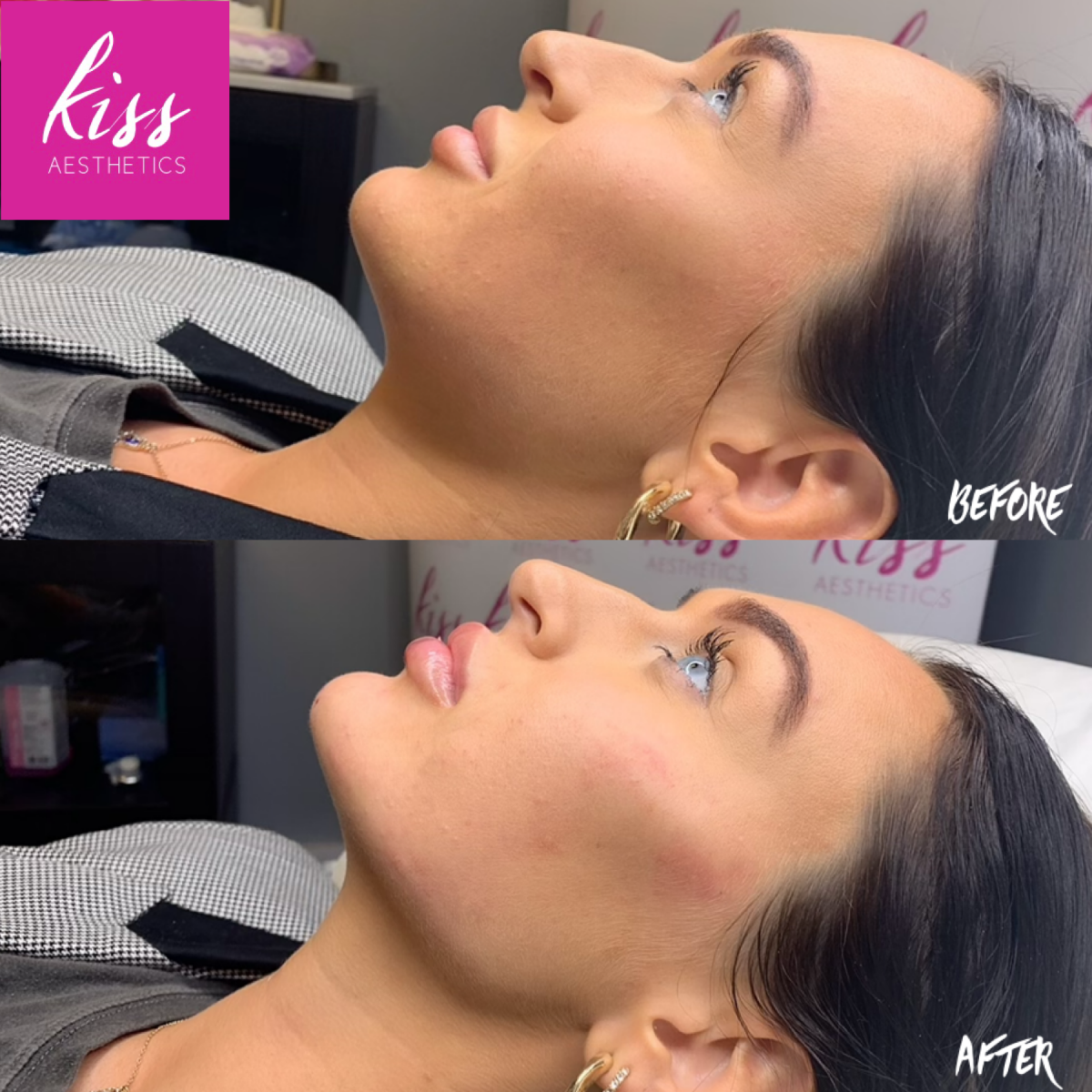 Essex - Kiss Aesthetics