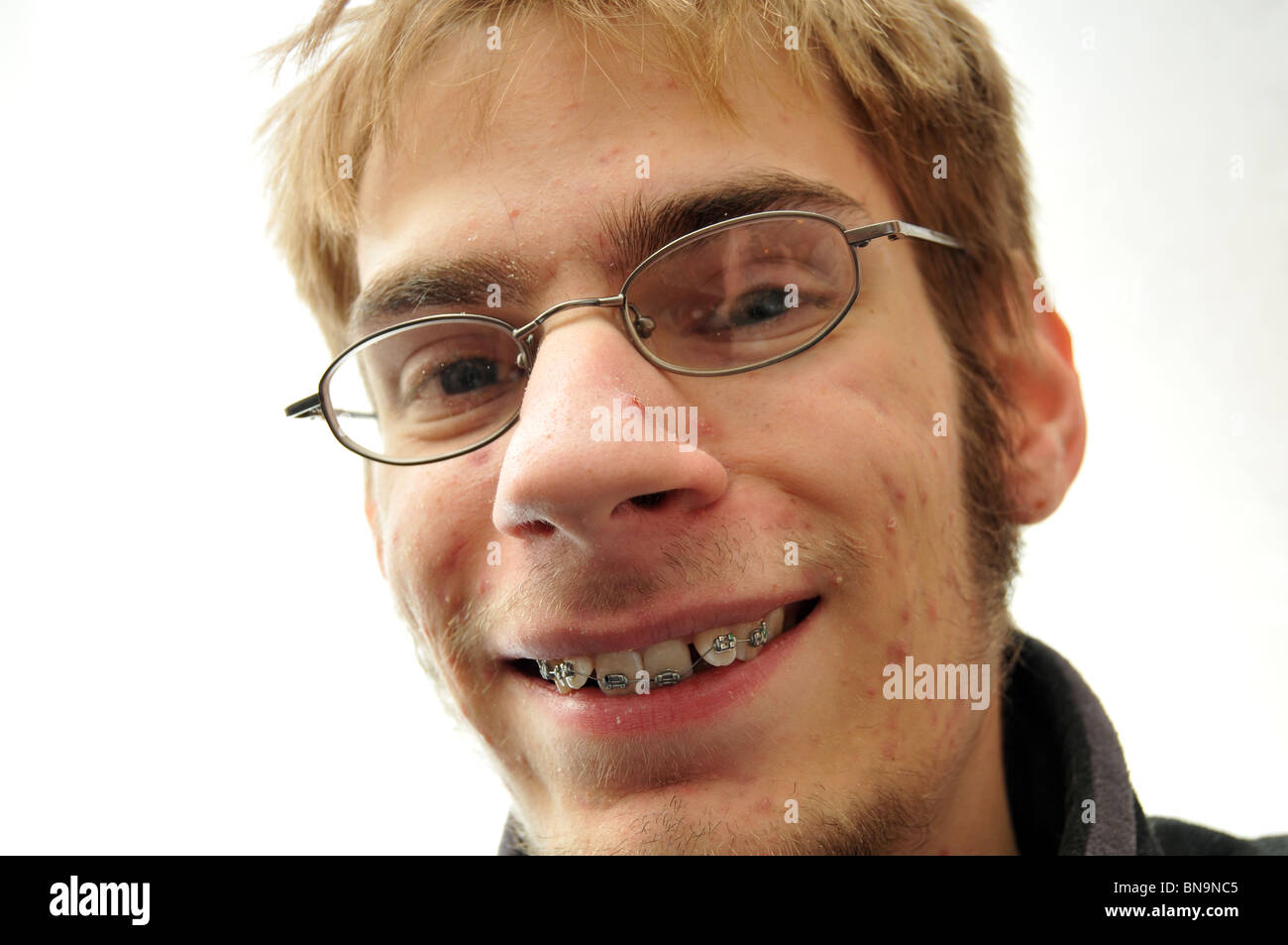 young-man-trying-to-smile-with-braces-and-glasses-BN9NC5.jpg