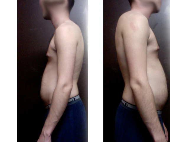 skinny-fat-profile7777.jpg