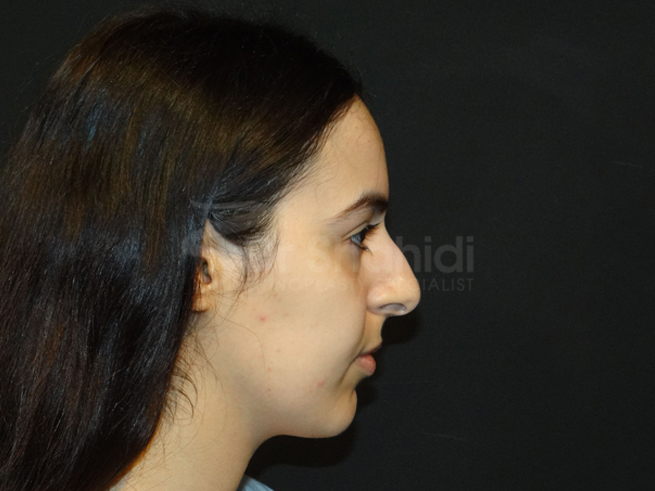 110.1-before.jpg