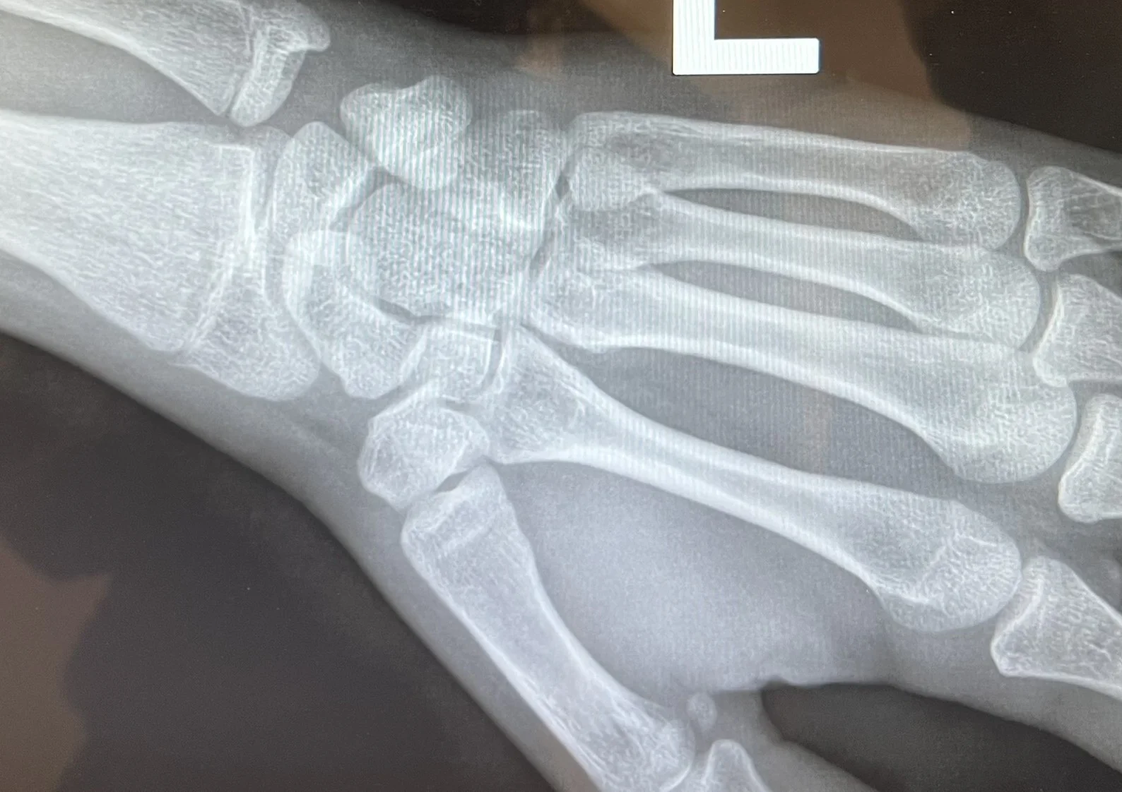 6665038_wrist_2.webp