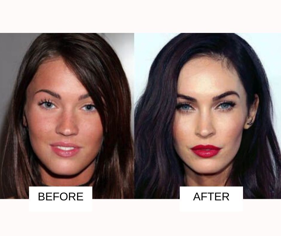 Megan-fox-plastic-surgery.jpg