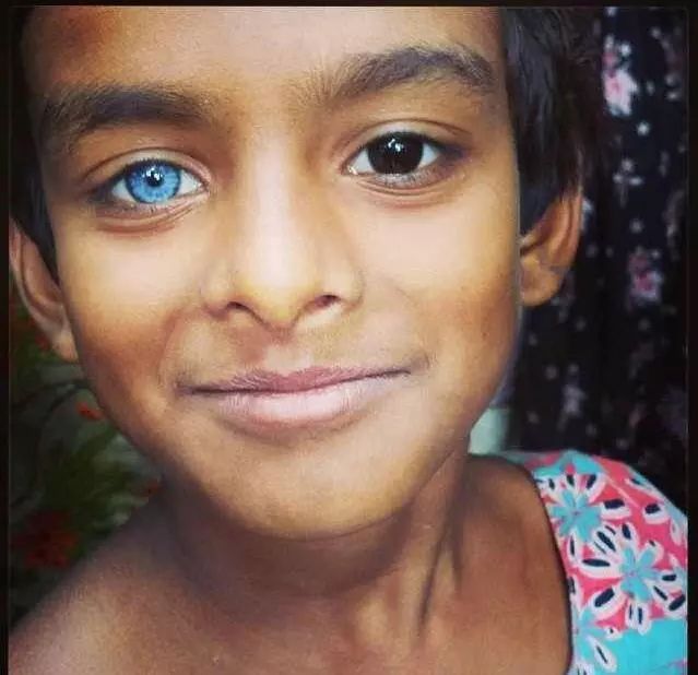 43 Heterochromia/ Bicolored Eyes ideas | heterochromia, beautiful eyes, eyes