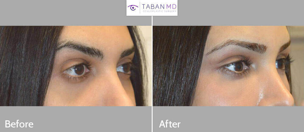 shayan-before-and-after-1b-mn.jpg