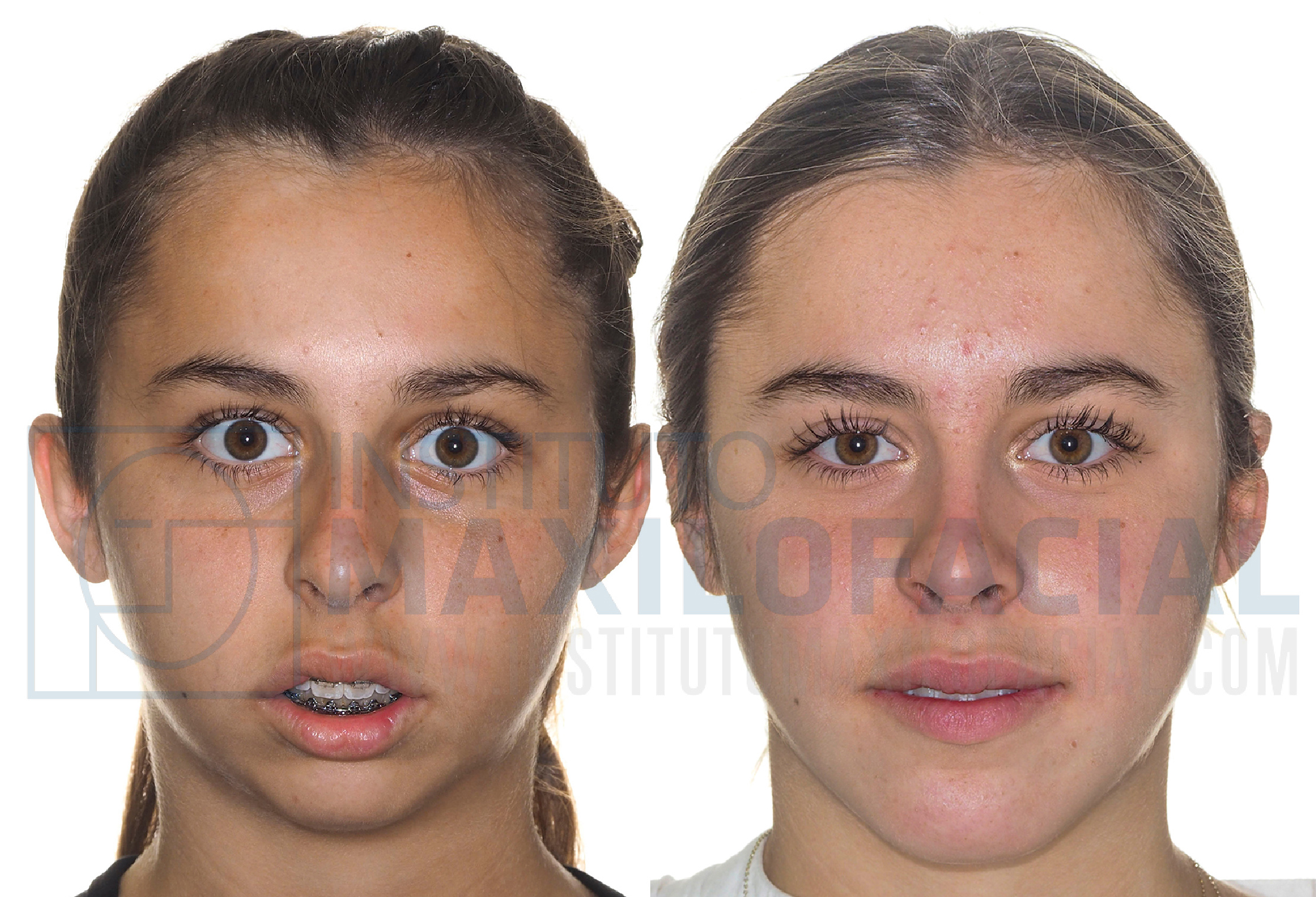 www.institutomaxilofacial.com