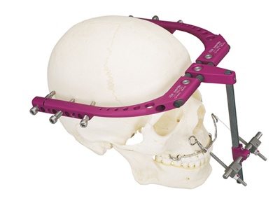 RED II System (Rigid External Distraction) from KLS Martin, L.P.