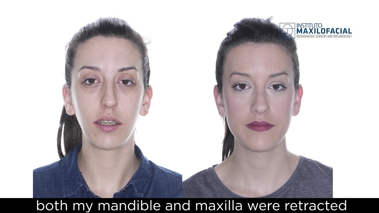 maxresdefault.jpg