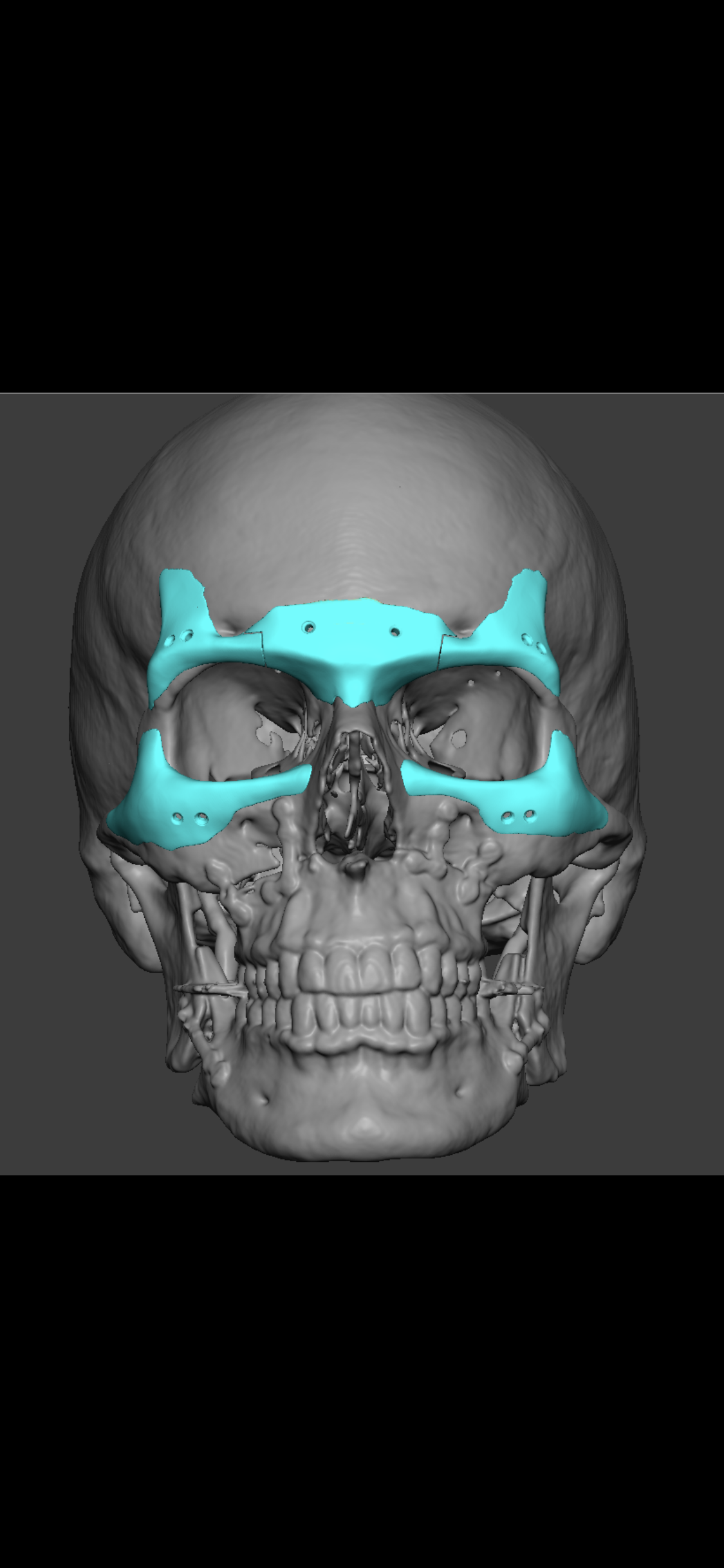 3073354_C489F6D1-9BF1-4CFE-A032-99FAF297C10B.png