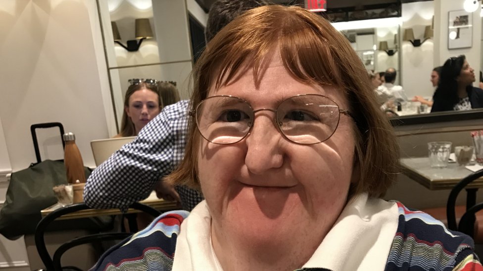 Disability blogger: 'Trolls said I was too ugly for selfies, so I hit back'  - BBC News