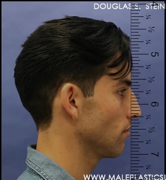 2725064 ginifabcom ruler 20220204014611