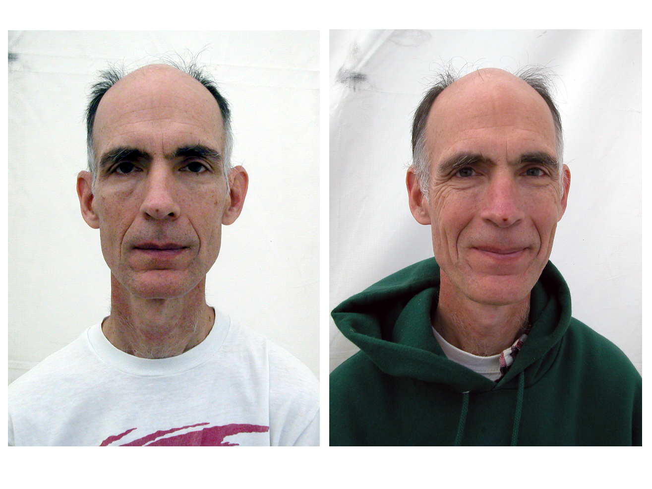 03beforeafterF.jpg