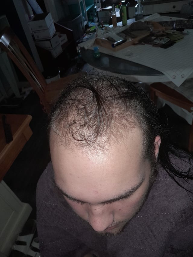 r/bald - Im(18m) getting my head shaved today