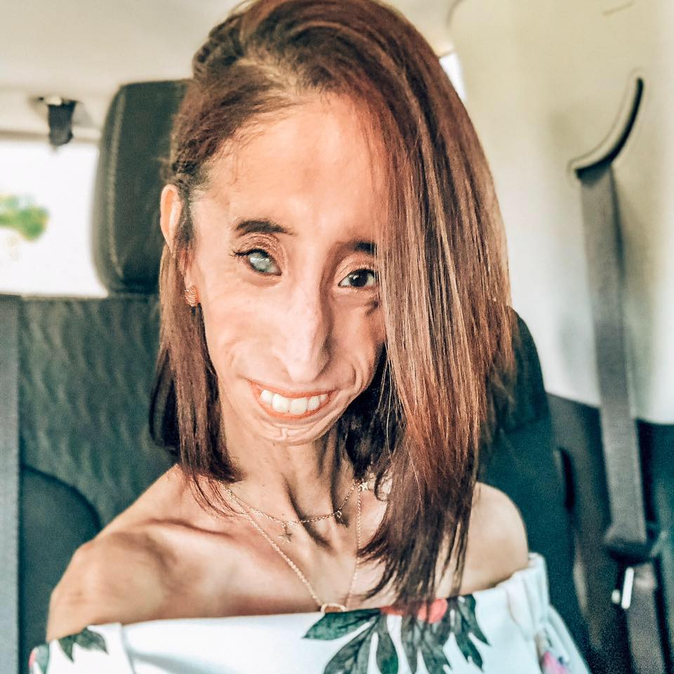 Lizzie-Velasquez.jpg