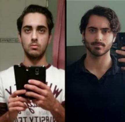 3083575_mewing-before-after-result-adult-age-18.jpeg