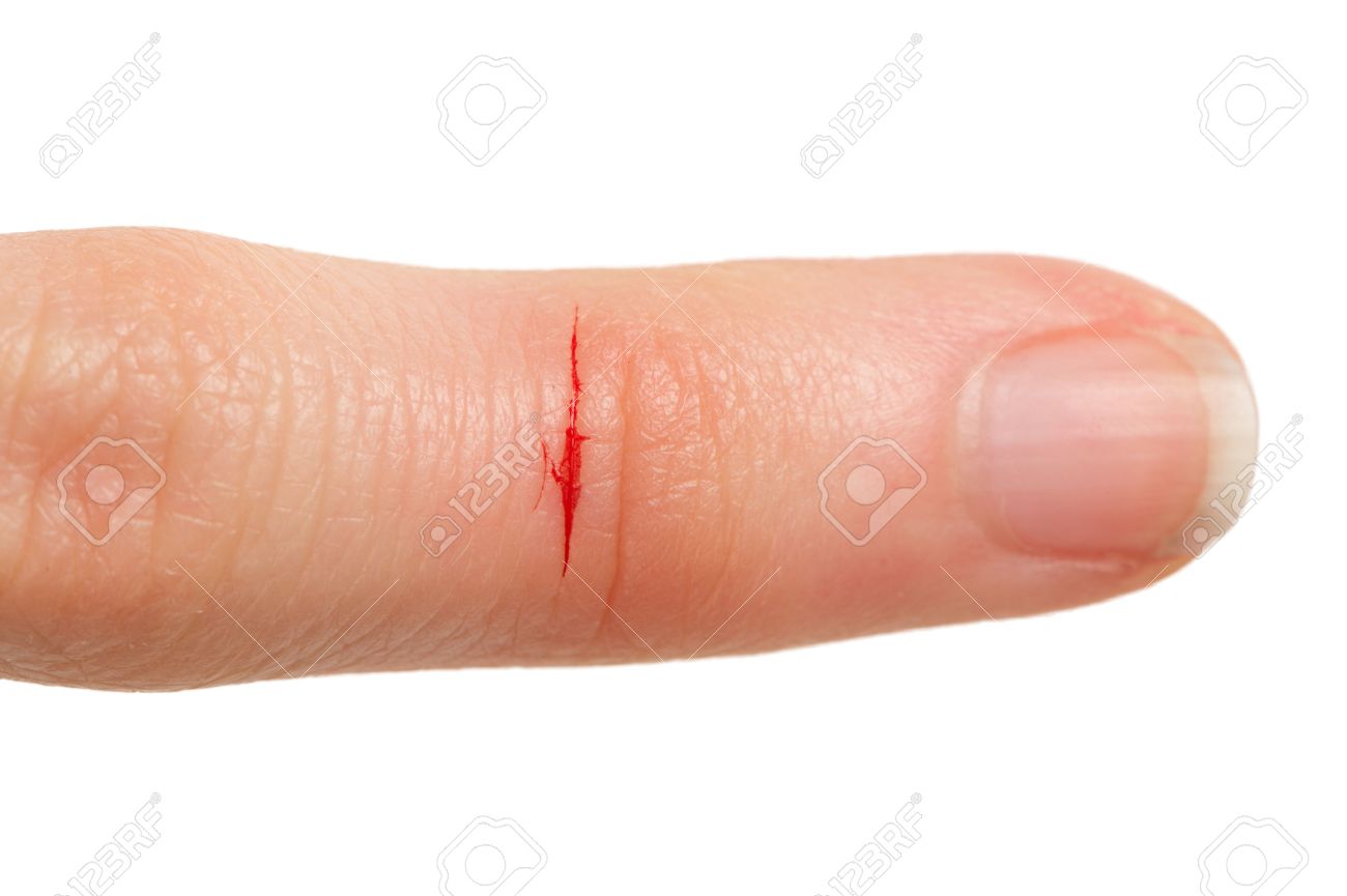46023124-cut-finger-with-blood.jpg
