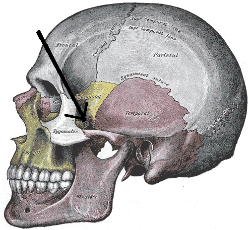 Gray188-Sphenozygomatic_suture.png