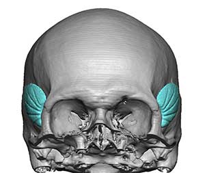 skullreshaping.com