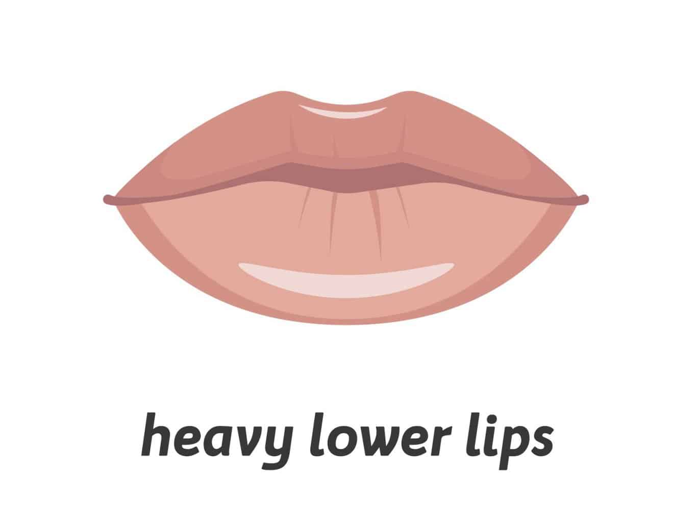 heavy-lower-lips-1536x1153.jpeg