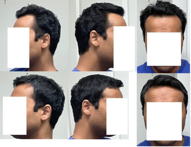 Hair.jpg