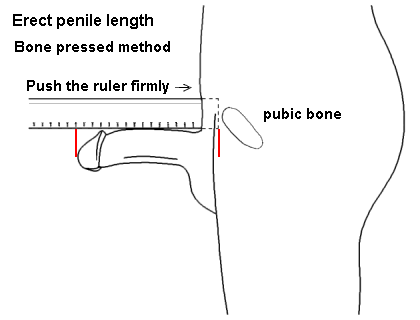 Erect_penile_length_%28Bone_pressed%29.png