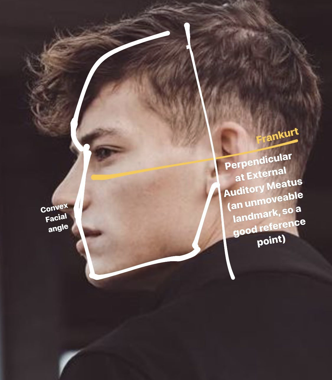 63CFCEAD 1C5B 4FD1 91BA 6E8C77ECE7CC