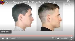 MSE2