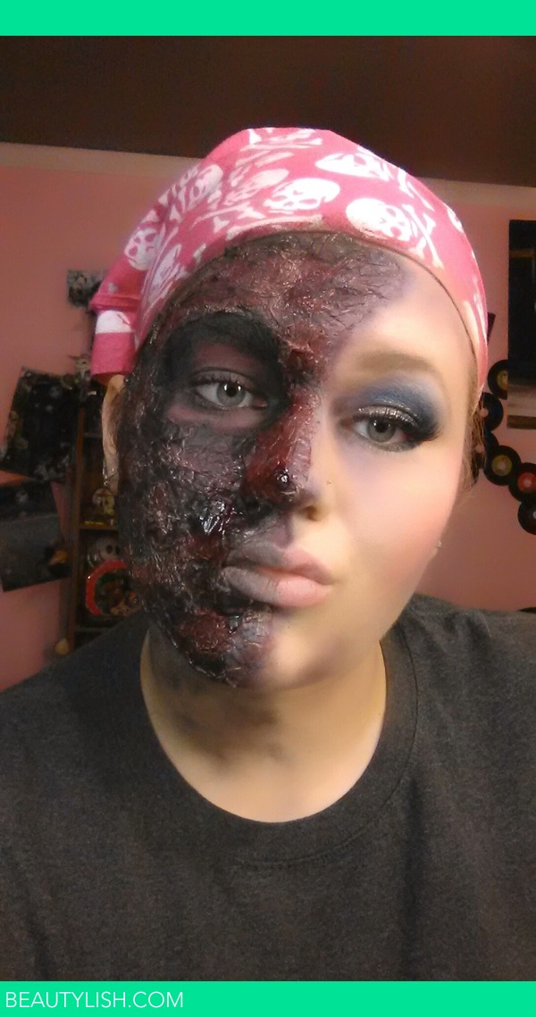 burn-victim.jpg