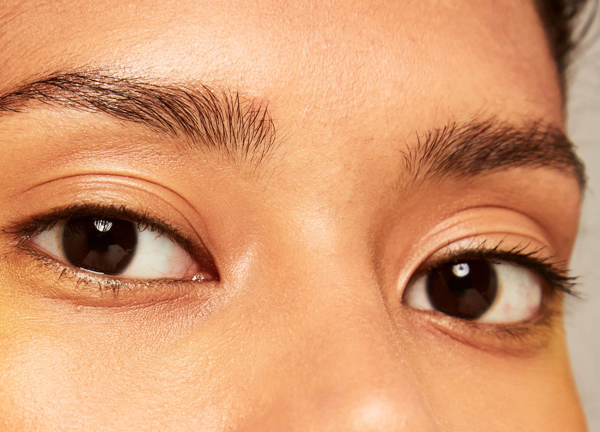 RS_eyelid-surgery.jpg