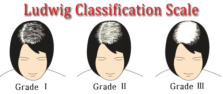 ludwig-classification-scale.png