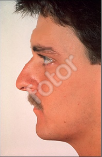 0KOXqjQ.png