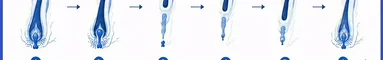 sonics-mi1d.webp