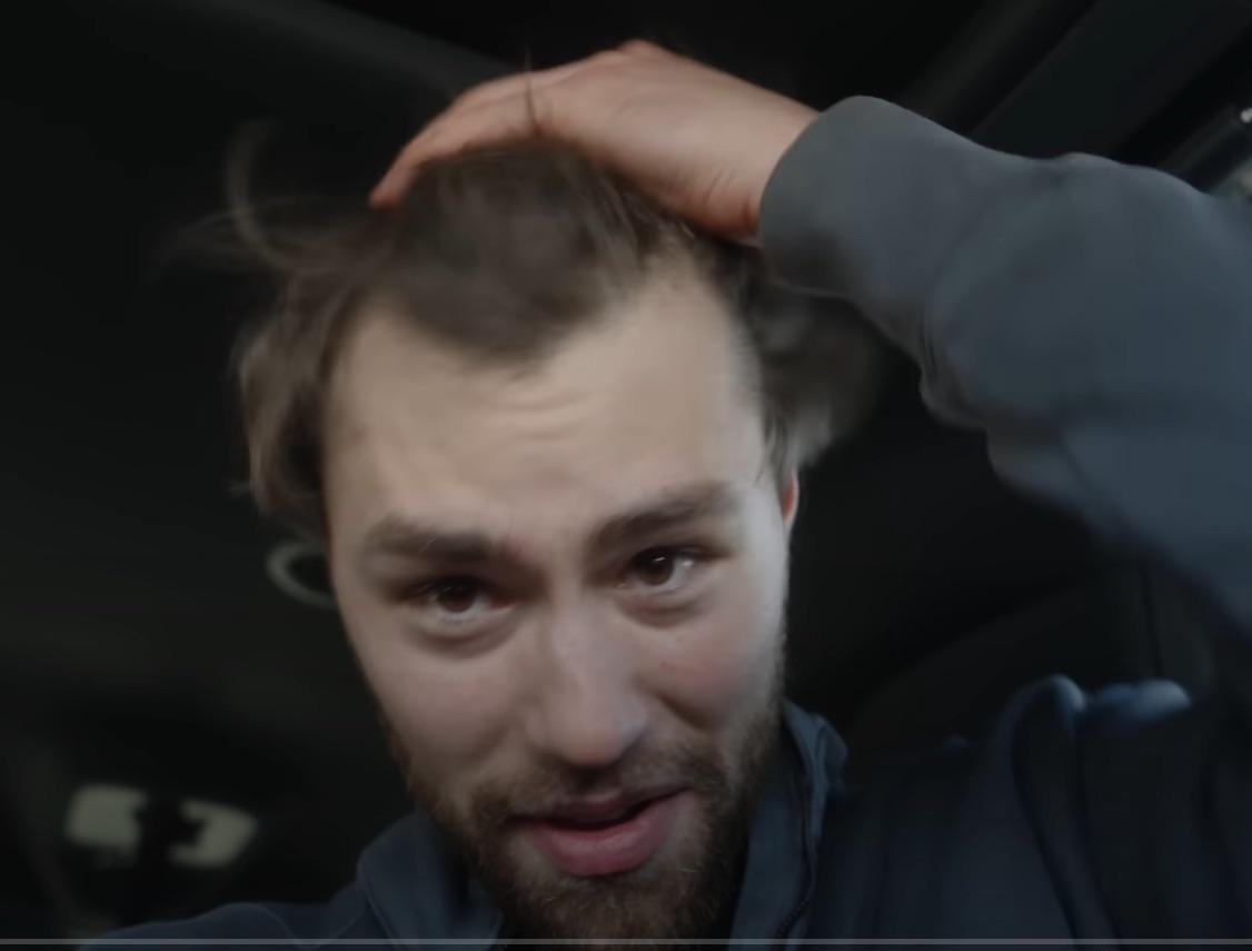 Even David Laid isn't safe 😭🙏 should've gotten a transplant with Cbum :  r/tressless
