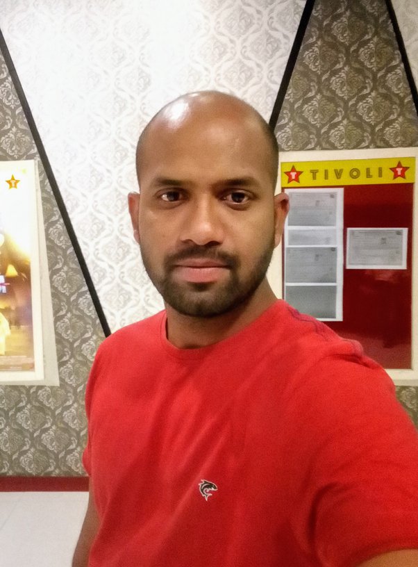 I'm a 22 year old Indian guy with male pattern baldness. I've lost 70% of  the hair at the top of my head. I think I should just shave the rest of