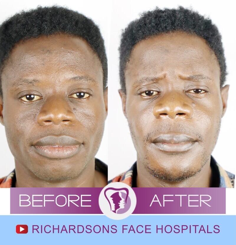Terry-Bijaw-Surgery.jpg