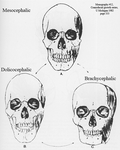 Brachycephalic_dolicocephalic_mesocephalic.jpg