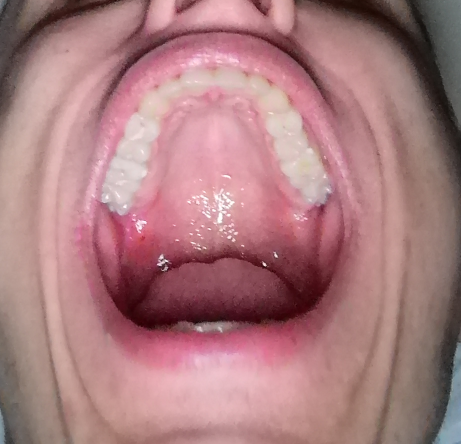 50a95bd893efce2f6fc2a7674a79c0a2.png