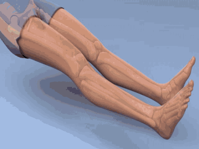 leg-surgery-rotationplasty.gif