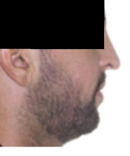 w1Xt2Im.jpg