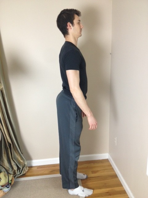 Lordosis-e1369525164523.jpeg