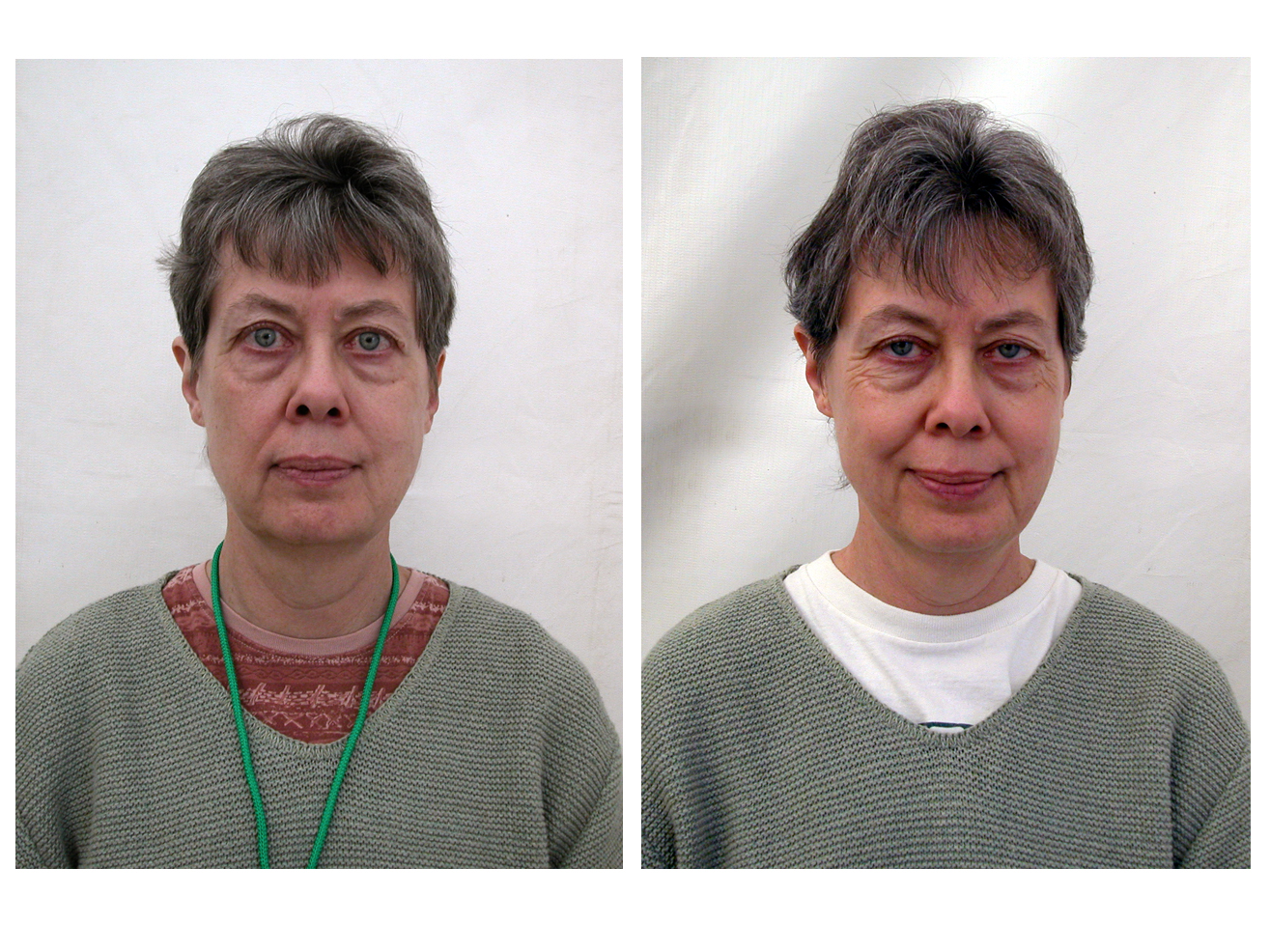 07beforeafterF.jpg