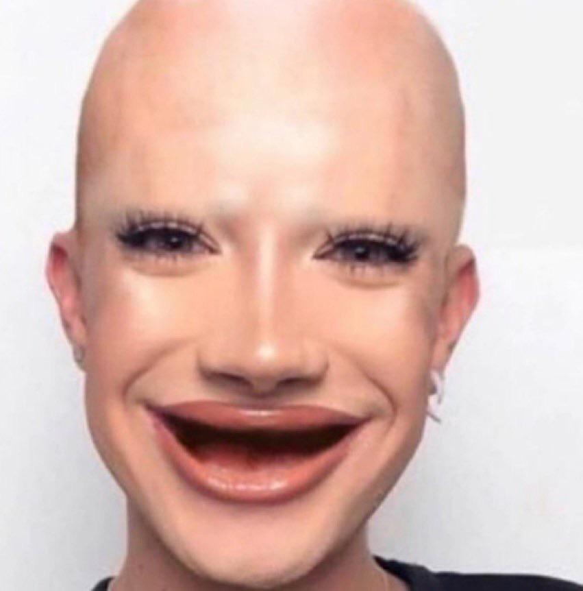 Thanks I hate hairless James Charles : TIHI