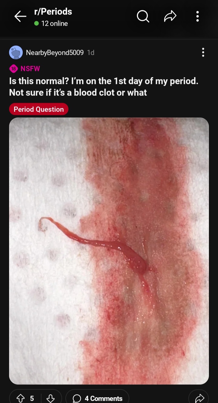 Screenshot 20240504 093432 Reddit