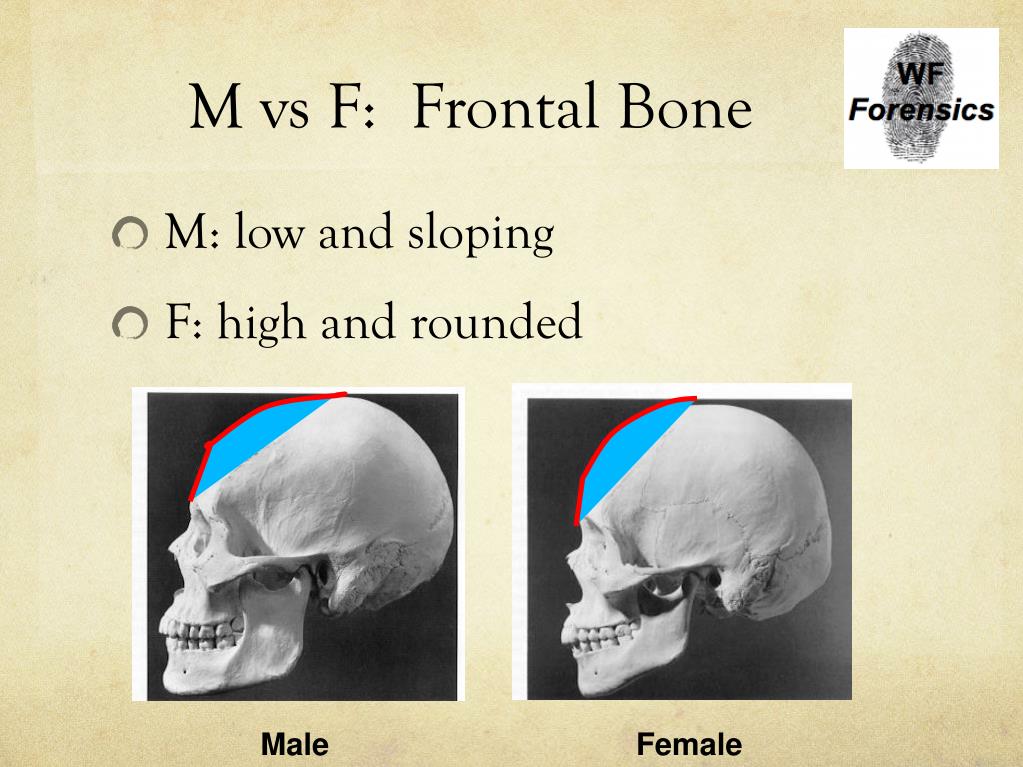 m-vs-f-frontal-bone-l.jpg