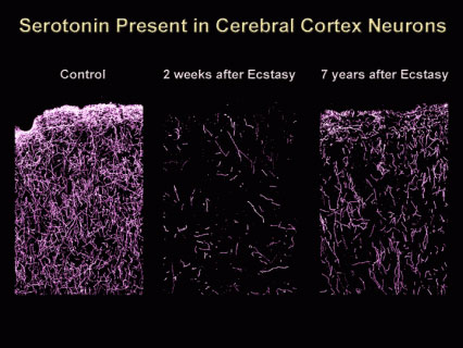 serotonin_present.jpg