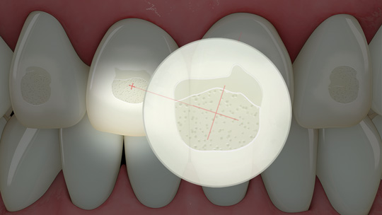 causes of crooked teeth