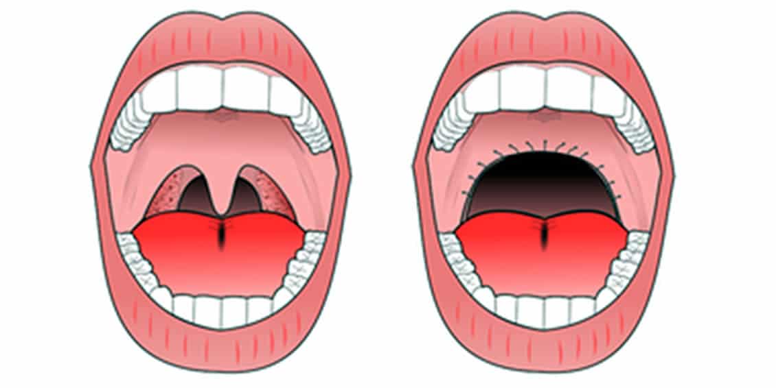 uppp-diagram.jpg