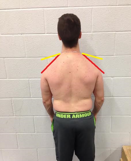 mike-shoulder-12.jpg