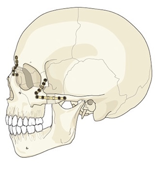 387A35A4 4FA3 4F77 81ED 30AED8CA05D3