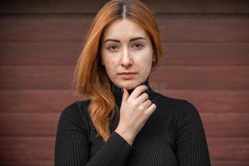 acne-scars-simple-woman-close-up-natural-portrait-no-makeup-retouch-problem-skin-body-positive-real-woman-skin-194048641.jpg