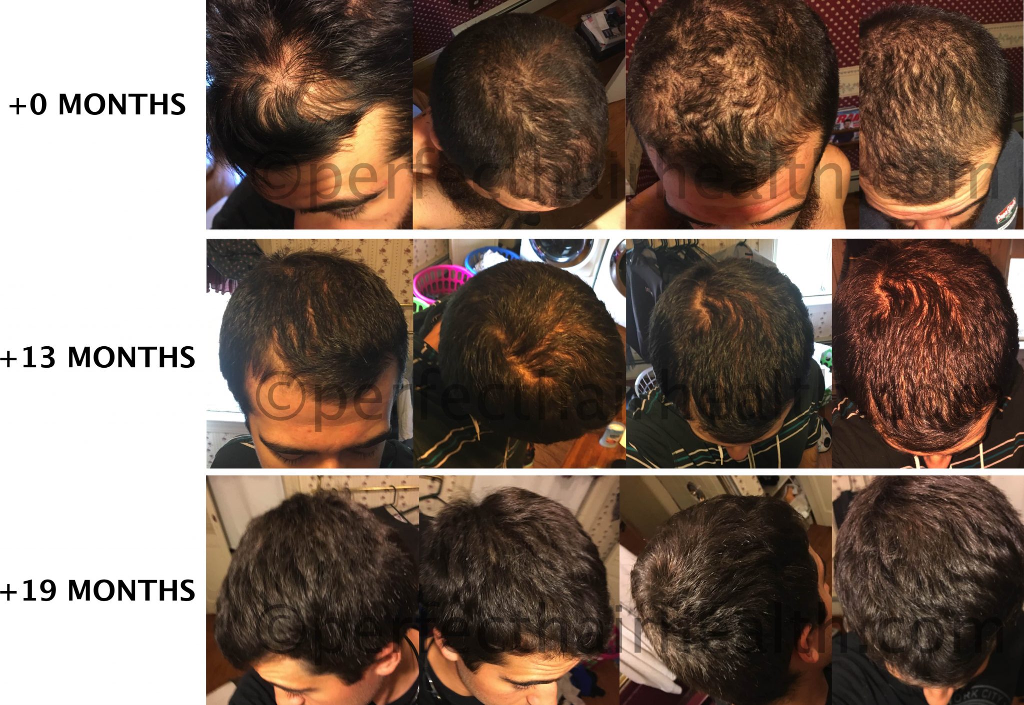 Ben-M-before-after-full-set-min.jpg